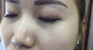 Before And After Treating Old Eyebrows - 9D 1 . Threaded Eyebrow Sculpture