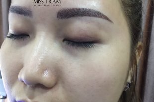 Before And After Treating Old Eyebrows - 9D 107 . Threaded Eyebrow Sculpture