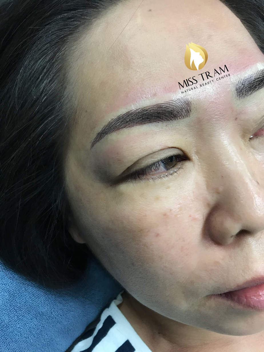 Before And After Using 9D 5 . Thread Brow Sculpting Technology