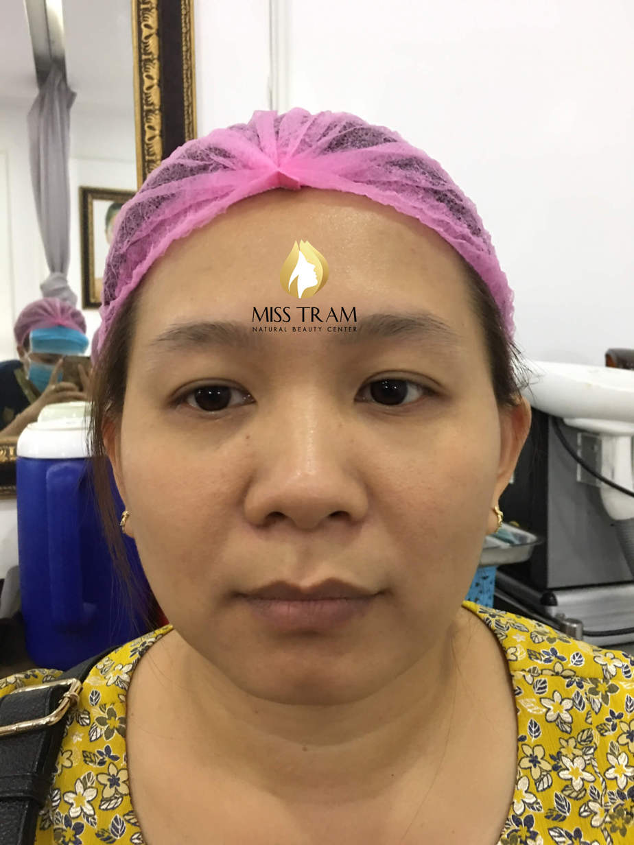 Before And After Using 9D 7 . Thread Brow Sculpting Technology