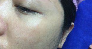 Before And After Making 9D Thread Brow Sculpting For Women 23