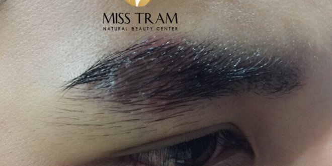 Before And After Sculpting Eyebrows and Scars For Men 4