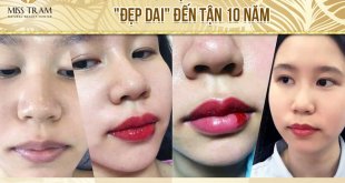 Before And After Spraying Queen Lips For Fresh Lips 10