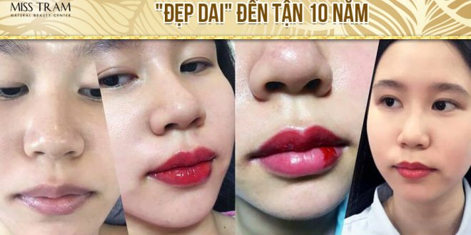 Before And After Spraying Queen Lips For Fresh Lips 2