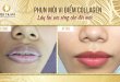 Before And After 11 . High-Tech Micro-Point Lip Spray