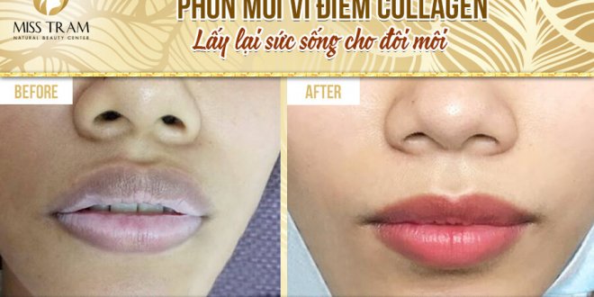 Before And After 2 . High-Tech Micro-Point Lip Spray