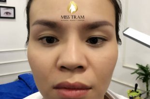 Before And After The Results Of Old Eyebrow Treatment, Ultra Fine Powder Spray 30