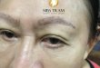 Fixing Damaged Eyebrows with 9D 33 . Thread Sculpting