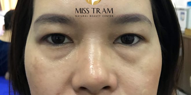Before And After Actual Results of Old Eyebrow Treatment, 9D Thread Sculpting, 4
