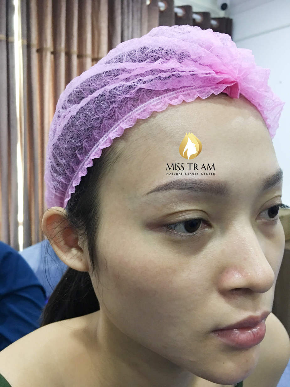 Before And After Results Of Old Eyebrow Treatment, Sculpting Combined With Super Fine Powder Spray 8