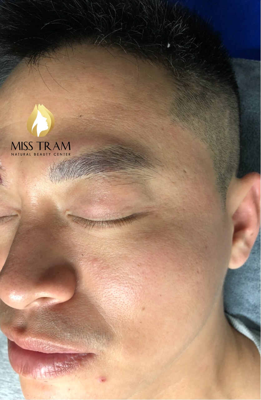 Before And After The Results Of Sculpting Flawless Eyebrows For Men 7