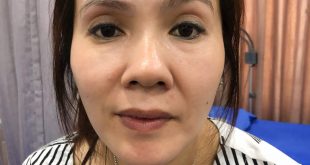 Before And After Sculpting 9D Threaded Eyebrows - Actual Image of Old Eyebrow Treatment 28