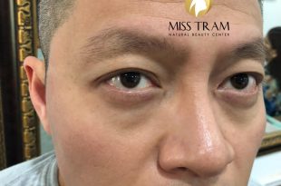 Before And After The Results Of Sculpting Flawless Eyebrows For Men 44