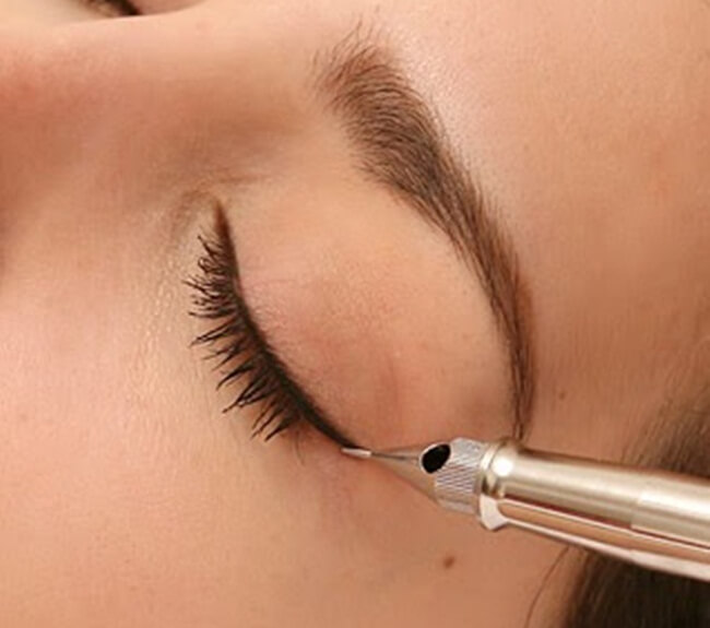 Standard and safe eyelid anesthesia technique