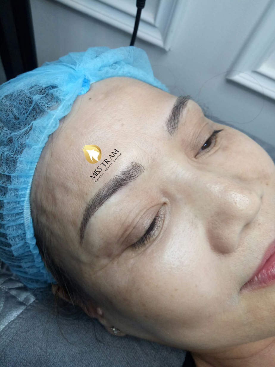 Before And After Using Eyebrow Sculpting Technology For Women 8