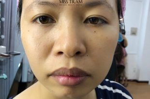 Before And After Brow Styling, Flawless Eyebrow Sculpting For Women 32