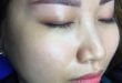 Treatment of Red and Blue Eyebrow Skin After Tattooing 46