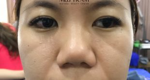 Before And After The Results Of 9D Flawless Eyebrow Sculpture For Women 97