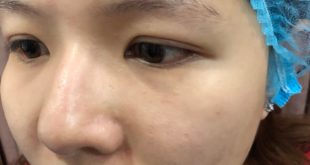 Before And After Creating Standard Eyebrows - 9D Threaded Eyebrow Sculpture 16