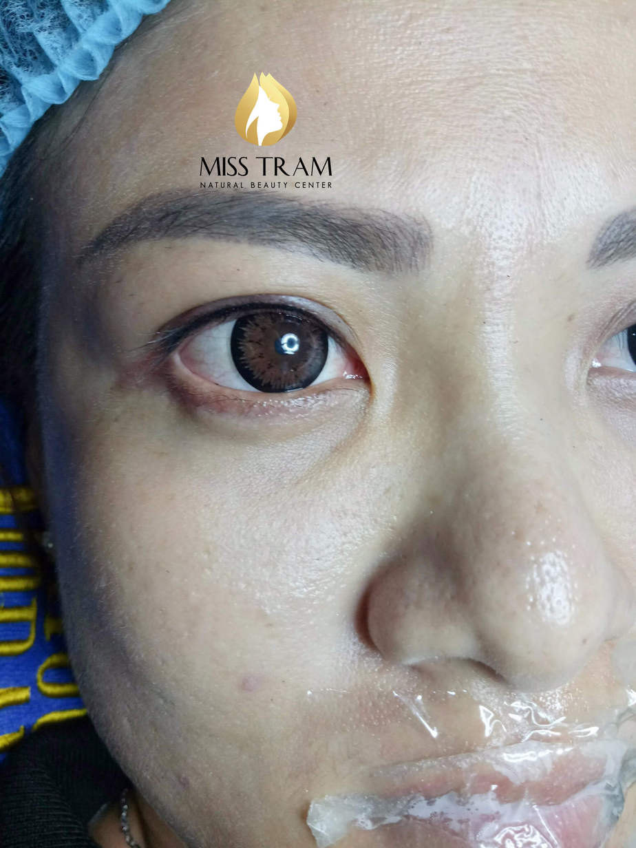 Before And After Eyelid Spray - For Beautiful Sparkling Eyes 8