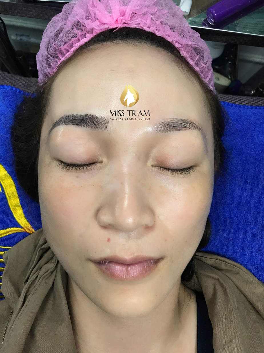 Before And After Making Eyebrow Sculpting Technology 7