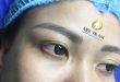 Before And After Eyelid Spray - For Beautiful Sparkling Eyes 5