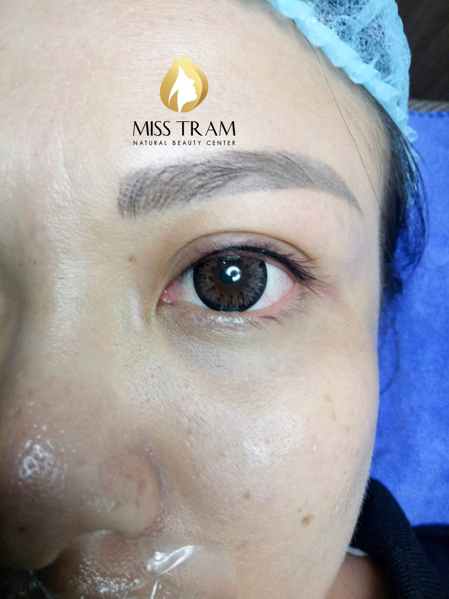 Before And After Eyelid Spray - For Beautiful Sparkling Eyes 9