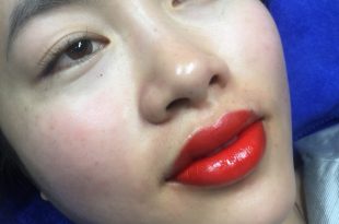 The secret to removing dark spots, lip color with high technology 100% without leaving scars 14
