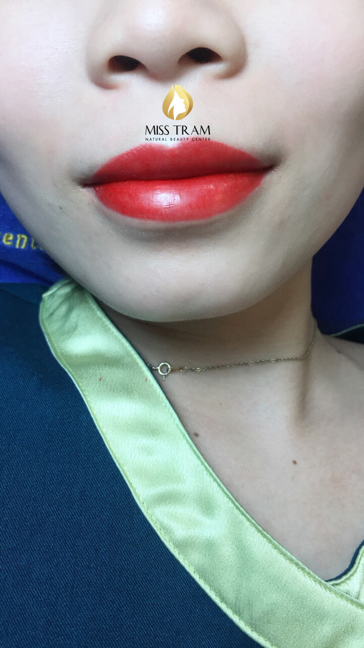 Before And After Queen Lip Sculpture - Actual Customer Photos 7