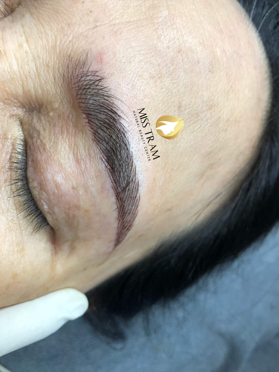 Before And After Eyelid Spraying, 9D Eyebrow Sculpting After Eyebrow Lifting 10