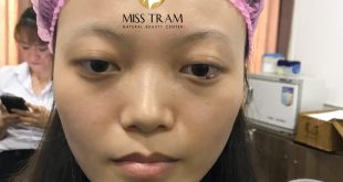 Before And After The Results Of Standard Eyebrow Styling, Flawless Eyebrow Sculpting For Women 6