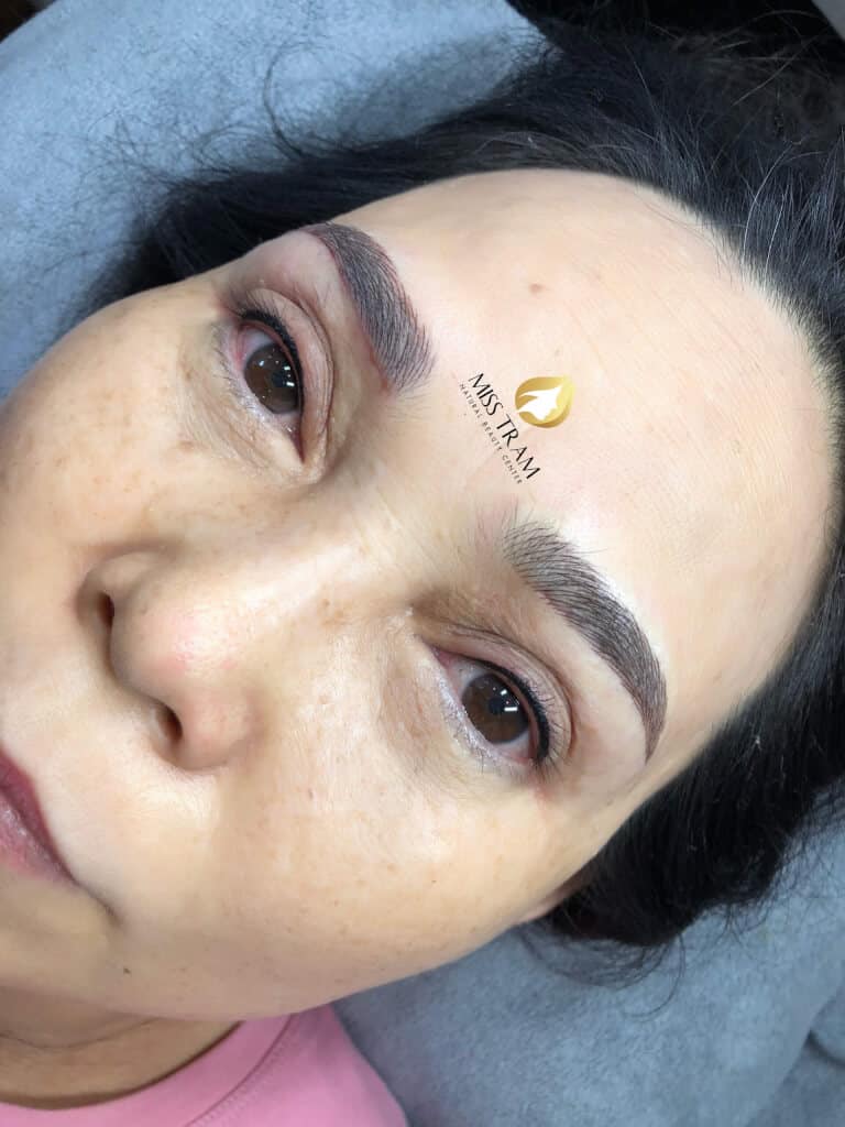 Before And After Eyelid Spraying, 9D Eyebrow Sculpting After Eyebrow Lifting 11