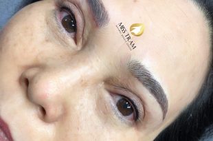 Before And After Eyelid Spraying, 9D Eyebrow Sculpting After Eyebrow Lifting 27