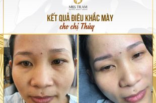 Before And After Beautifying With Eyebrow Sculpting Technology 19
