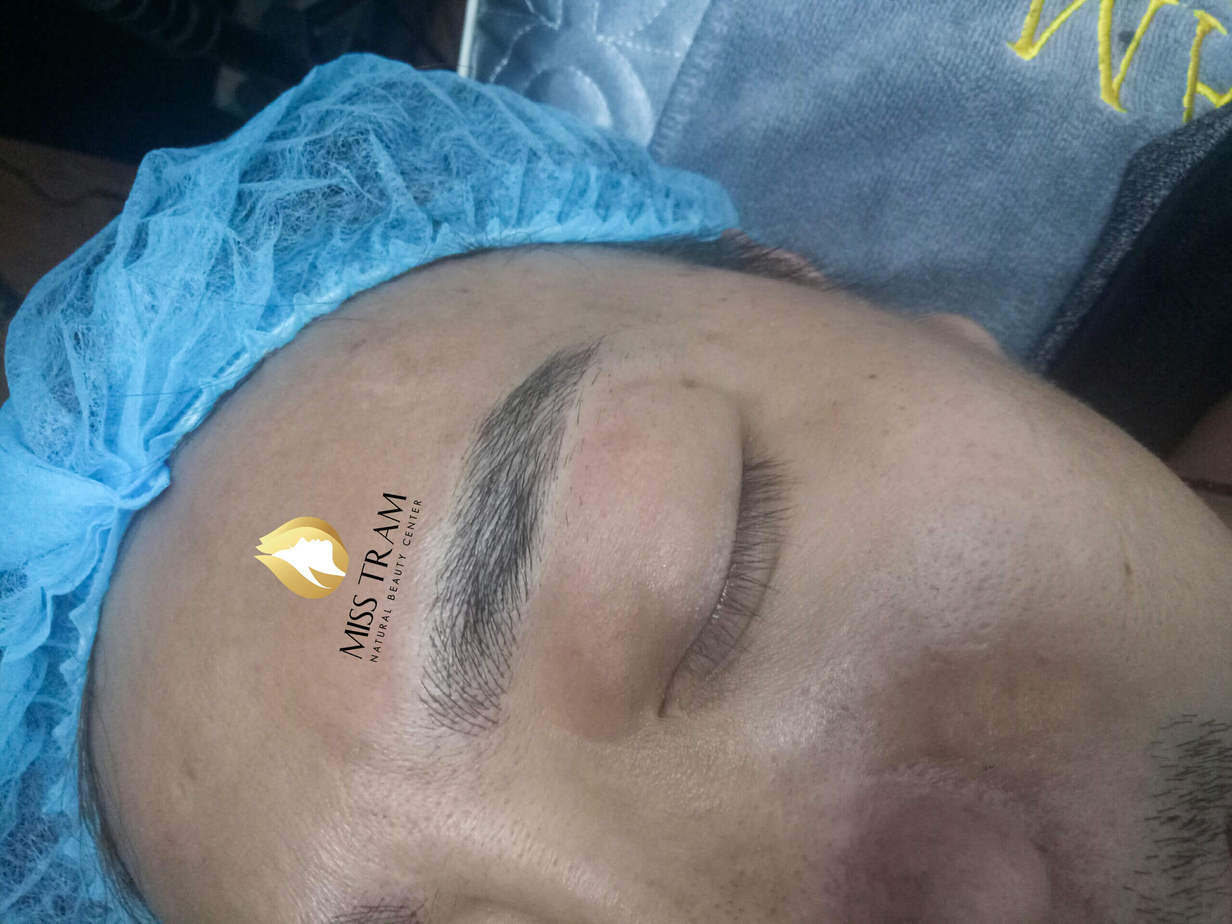 Results Before And After Making Eyebrow Sculpting For Men 9