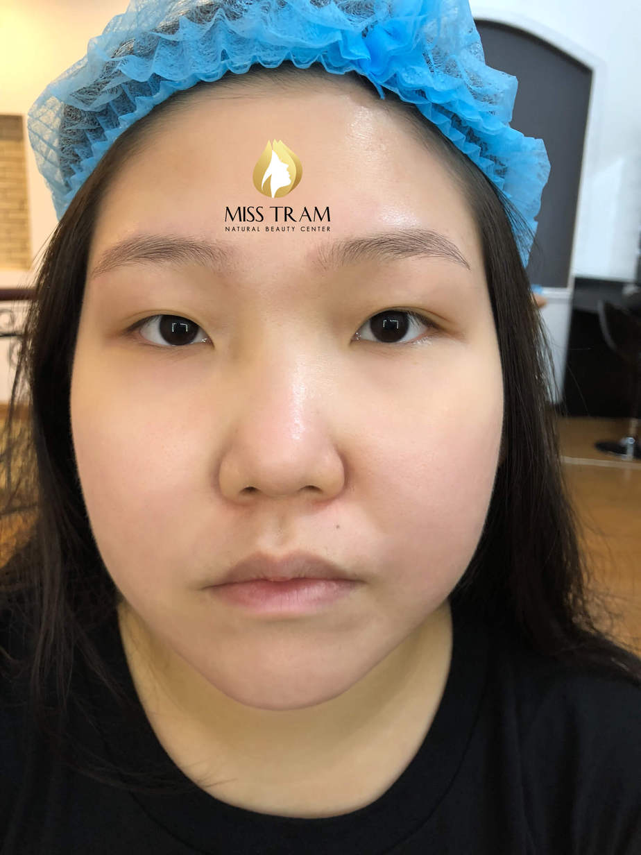 Before And After Using 9D 6 . Eyebrow Sculpting Technology