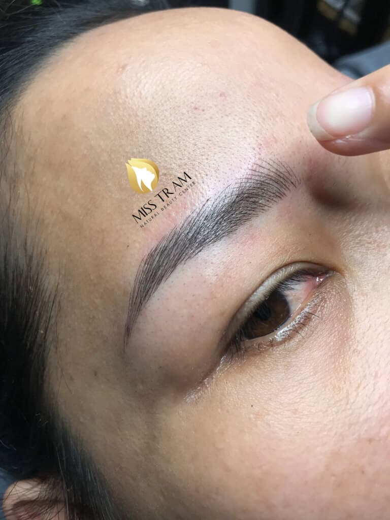 Before And After Beautifying With Eyebrow Sculpting Technology 8