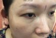 Before And After Treating Old Eyebrows, Shaping New Eyebrows With Sculpting Technology 5
