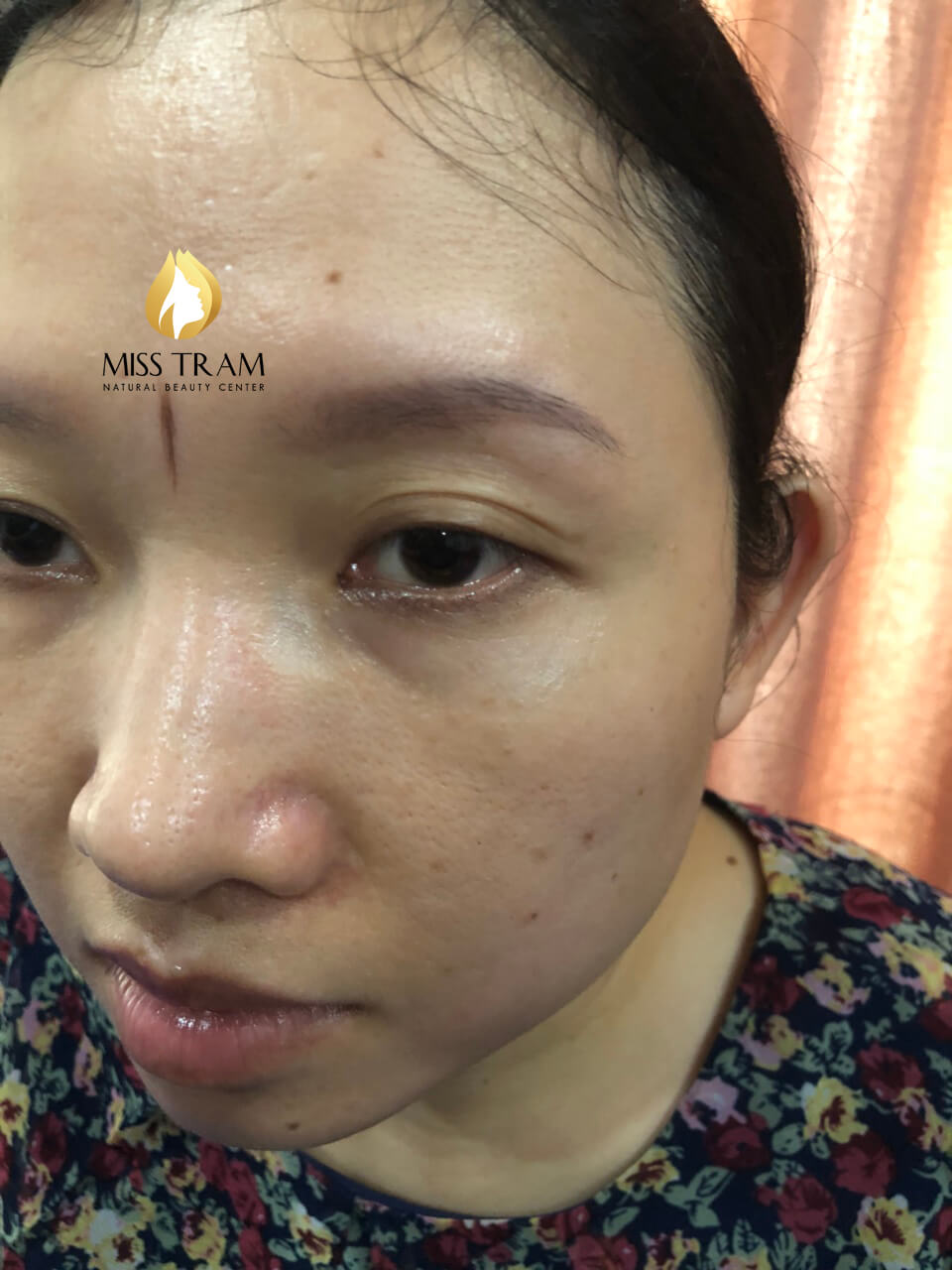 Before And After Treating Old Eyebrows, Shaping New Eyebrows With Sculpting Technology 7
