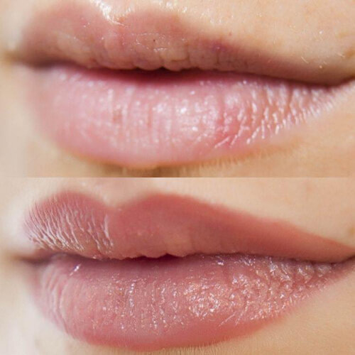The Most Effective Way to Fix Dark Spray Lips 4