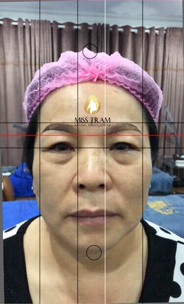 Before And After Sculpting Eyebrows with Fibers Combined with Eyelid Spray 6
