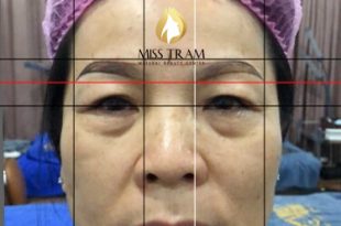 Before And After Sculpting Eyebrows with Fibers Combined with Eyelid Spray 43