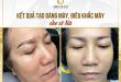 Before And After Shaping Your Eyebrows With Eyebrow Sculpting 52