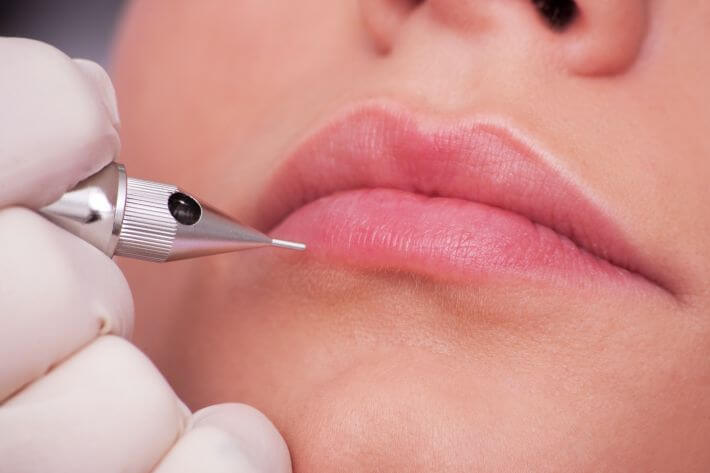 Is lip injection painful?