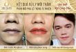 Before And After Spraying Crystal Lips In Nature For Men 10