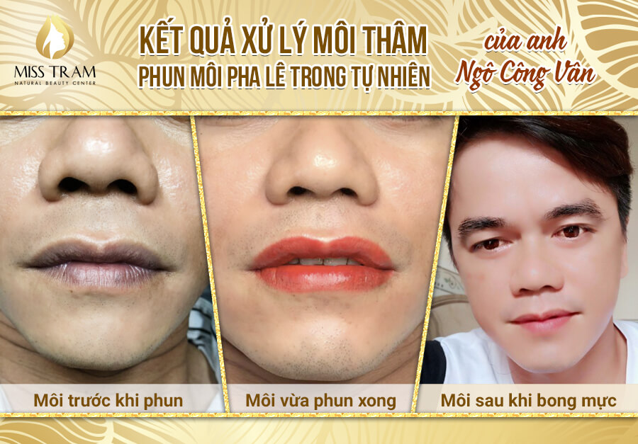 Người đàn ông trốn vợ đi xăm môi khử thâm và cái kết cười bò 2sao #7 Người đàn ông trốn vợ đi xăm môi khử thâm và cái kết cười bò 2sao
