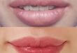 The Most Effective Way to Fix Darkened Spray Lips 43