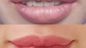The Most Effective Way to Fix Darkened Spray Lips 1