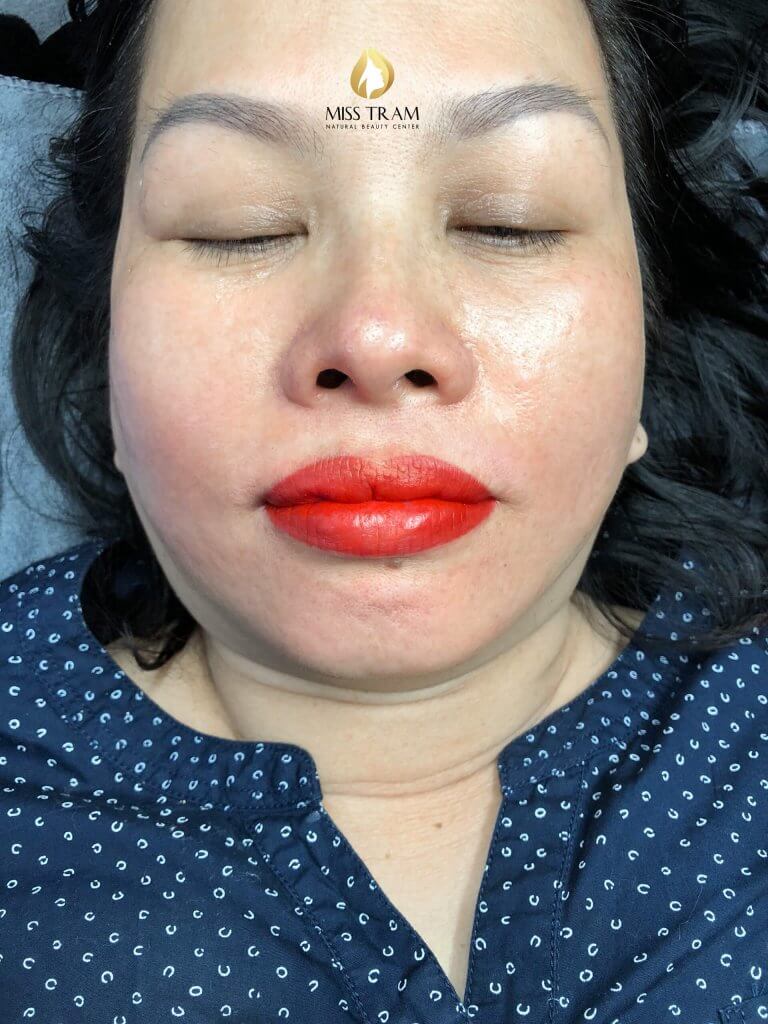 Before And After Performing Queen Collagen Lip Spray Technology 6