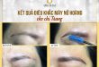 Before And After The Queen's Eyebrow Sculpting Results For Women 15